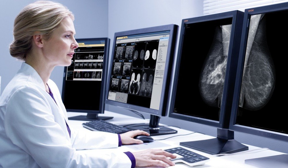 МРТ молочной железы