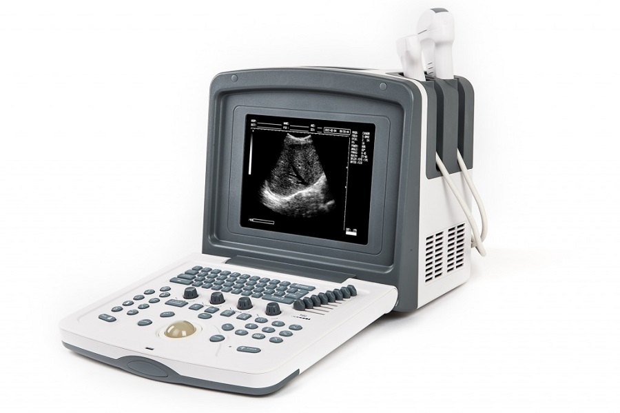 Портативные УЗИ аппараты: особенности и применение