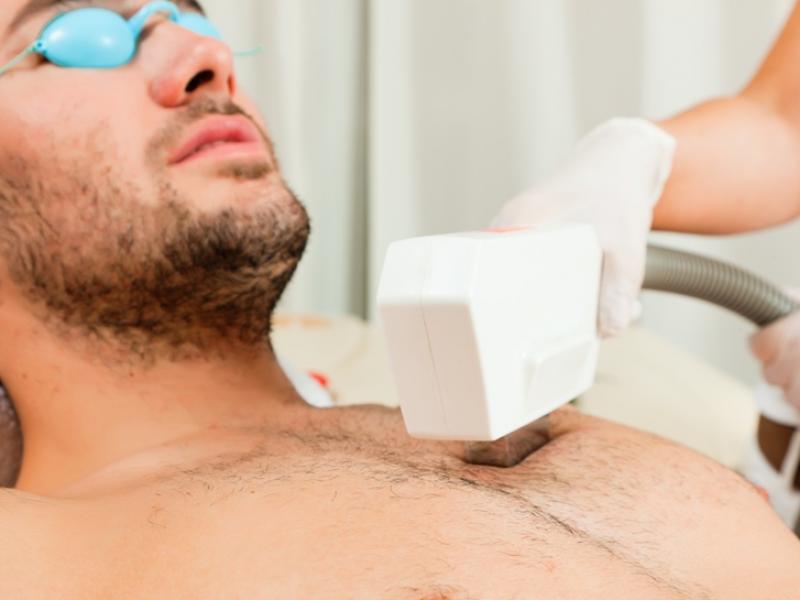 Мужская лазерная эпиляция: кому стоит ее делать