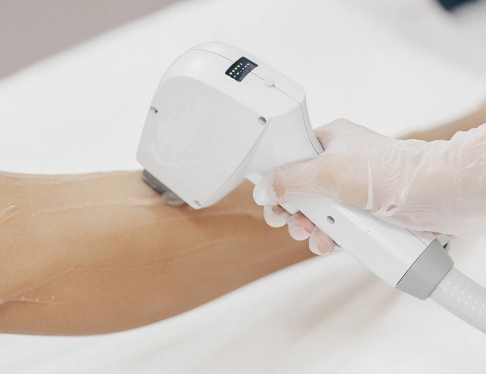 Преимущества и особенности лазерной эпиляции