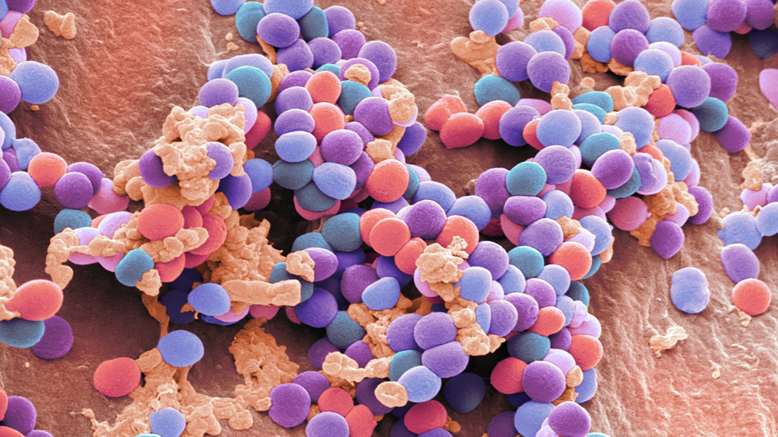 К вопросу о том, что такое стафилококк