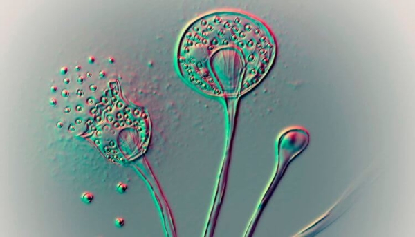 В мире растет количество грибковых инфекций. Почему это происходит и чем грозит? - Hi-News.ru