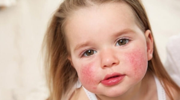 Может ли человек умереть в море с рыбами, если у него аллергия на морепродукты? - Hi-News.ru