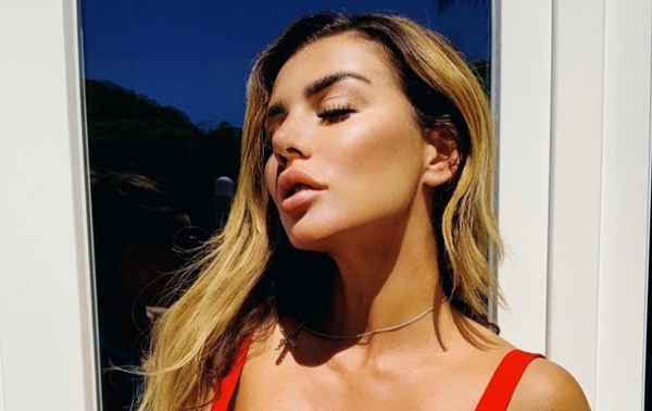 Седокова показала тело в пятнах и опухшее лицо