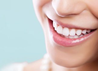 Имплантация зубов