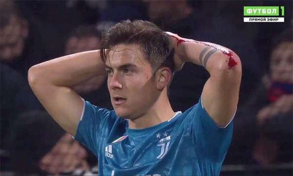 Эпично окровавленный де Лигт: ему разбили голову и расцарапали грудь