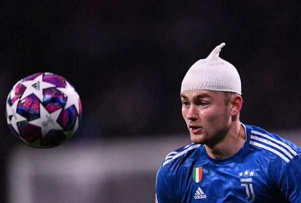 Эпично окровавленный де Лигт: ему разбили голову и расцарапали грудь