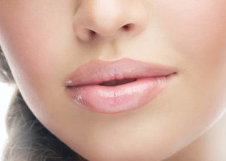 Контурная пластика губ: специфика проведения