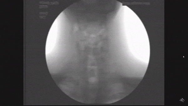 Люди умеют не дышать по 20 минут, игнорируя защитные рефлексы. Возможно, это вредит работе мозга