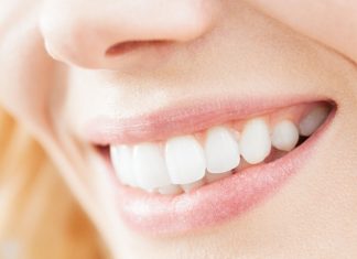 Имплантация зубов