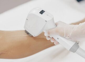 Преимущества и особенности лазерной эпиляции