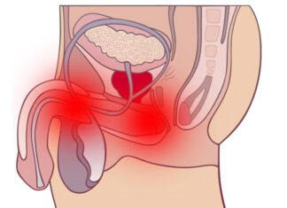 Как правильно лечить простатит