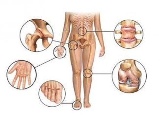 Самые распространенные болезни суставов