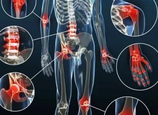Самые распространённые и опасные заболевания суставов