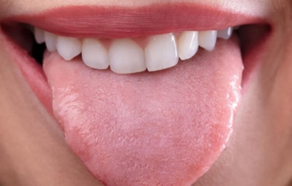 Цвет языка может многое рассказать о вашем здоровье: проверьте себя прямо сейчас - Hi-News.ru