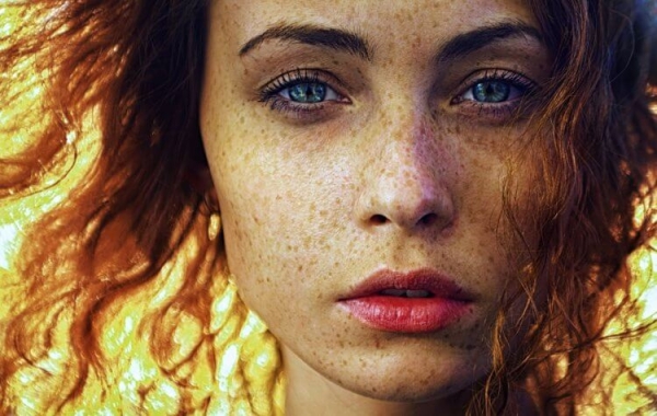Почему у некоторых людей появляются веснушки, а у других нет - Hi-News.ru