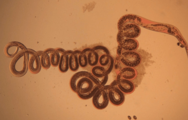 Пластырь из глистов: ученые нашли способ заживлять раны без шрамов - Hi-News.ru