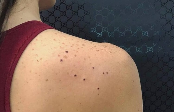 Почему у некоторых людей появляются веснушки, а у других нет - Hi-News.ru