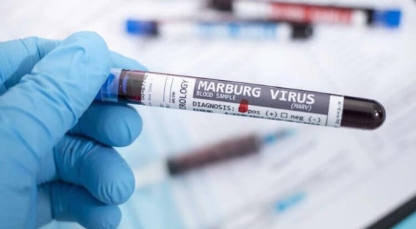 Вирус Марбург: что известно о болезни, которая может стать причиной новой эпидемии? - Hi-News.ru