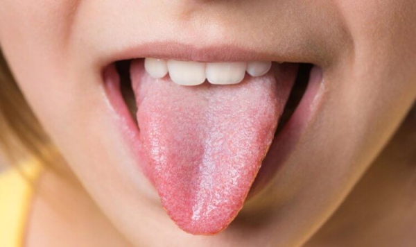 Цвет языка может многое рассказать о вашем здоровье: проверьте себя прямо сейчас - Hi-News.ru